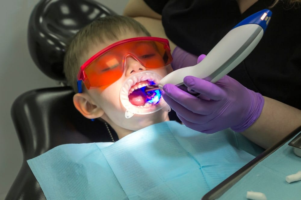 A child in orange protective glasses with a mouth retractor gets a dental procedure with a curing light by a gloved hand