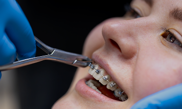 Dentist adjusts patient's braces with a tool