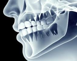 X-ray visualization of a human jaw with teeth and bone structure