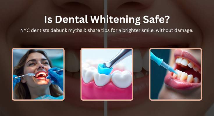 Is Dental Whitening Safe? NYC Experts Reveal the Truth