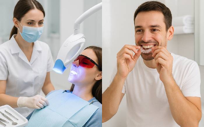 In office vs at home whitening nyc