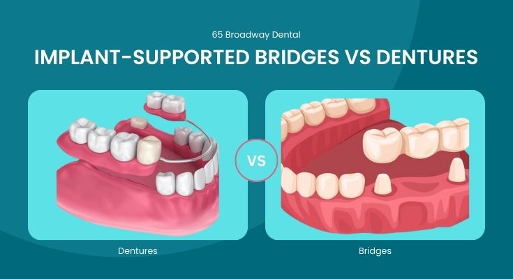 Implant-Supported Bridges vs Dentures: Which is Better?