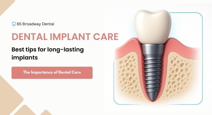 Dental Implant Care in NYC: How to Make Your Investment Last