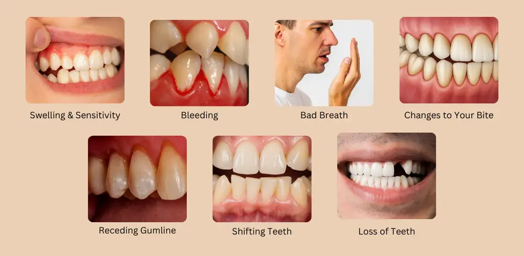 Signs of gum disease and treatment