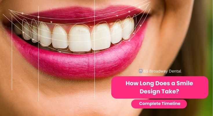 How Long Does a Smile Design Take?
