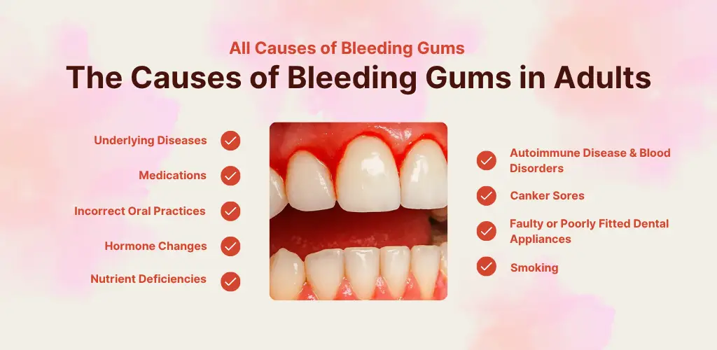 Causes of bleeding gums