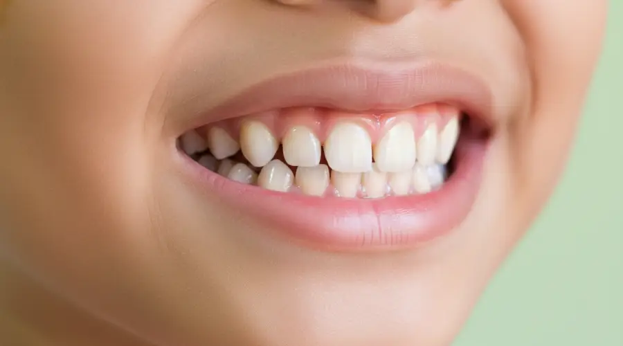 Child and his diastema