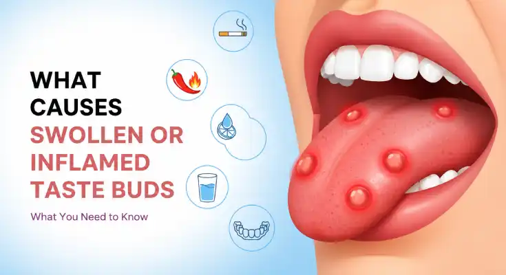 What Causes Swollen or Inflamed Taste Buds?