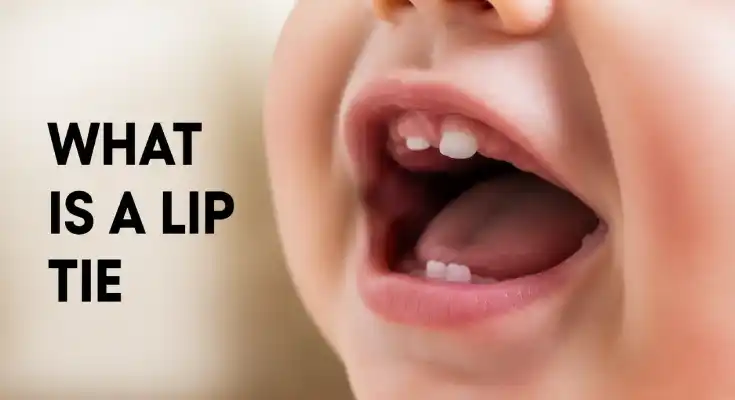 What Is a Lip Tie? Causes, Signs, and Simple Ways to Help Your Child