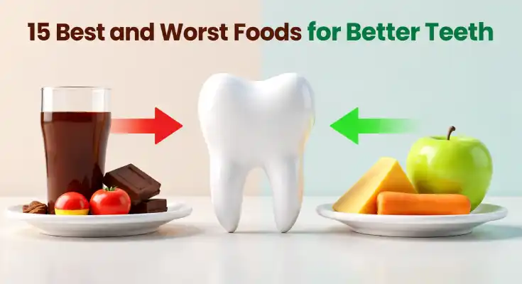 15 Best and Worst Foods for Better Teeth (Dentist-Approved Guide)