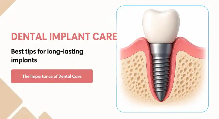 Dental Implant Care in NYC: How to Make Your Investment Last