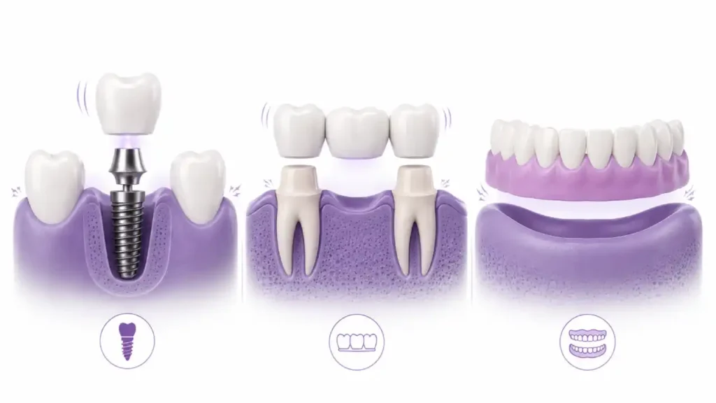 Comparison of dental implants, dental bridges, and removable dentures for missing teeth