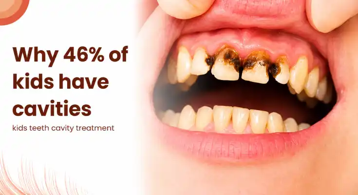 Causes & Treatments for Kids’ Cavities