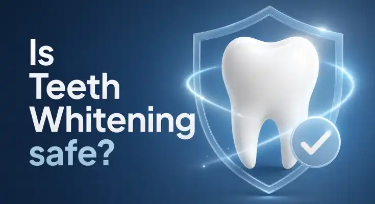 Is Teeth Whitening Safe? A Dentist Explains What’s Real and What’s Not